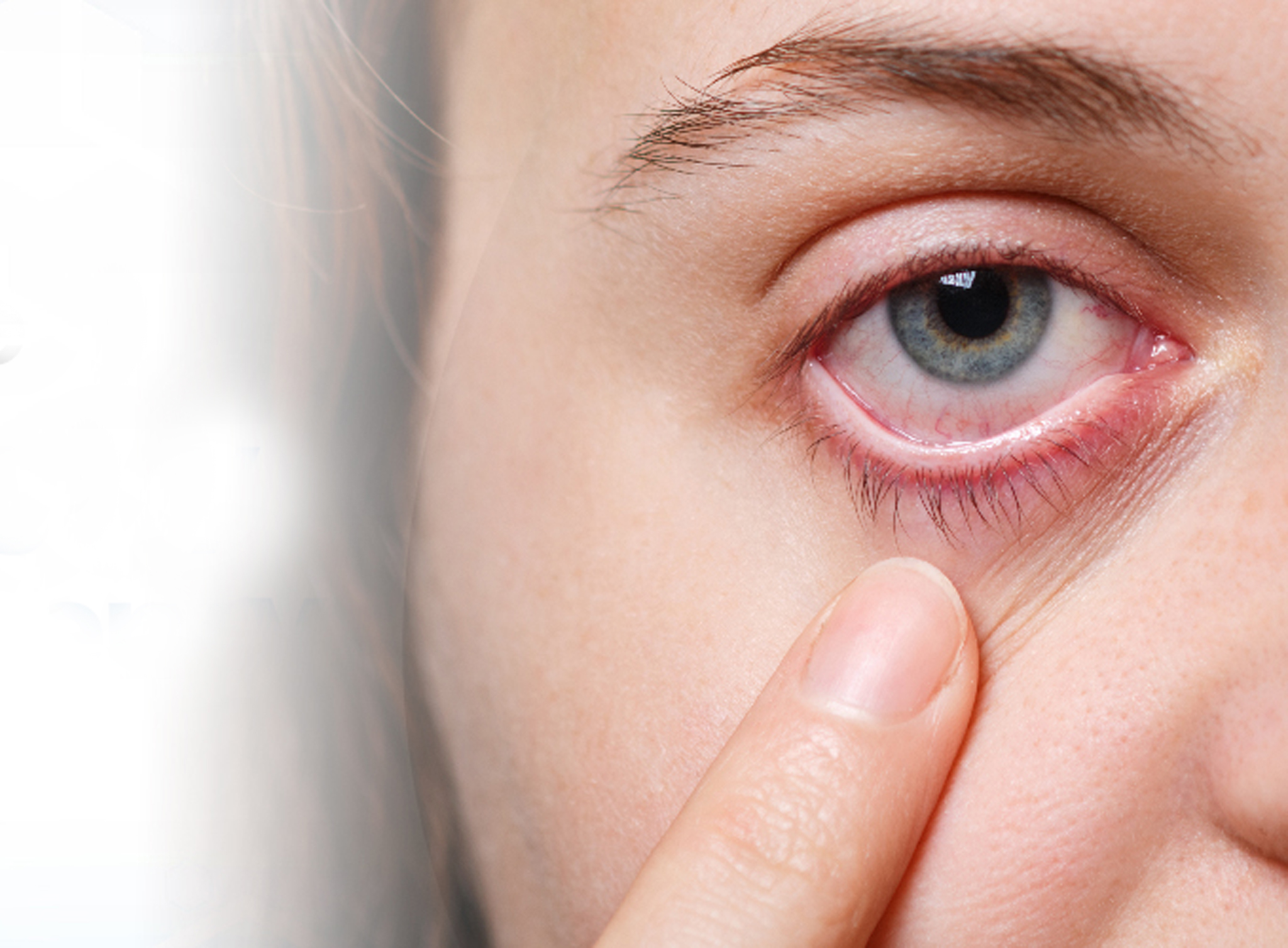 What is Glaucoma? Know Symptoms, Signs, and Treatment Options