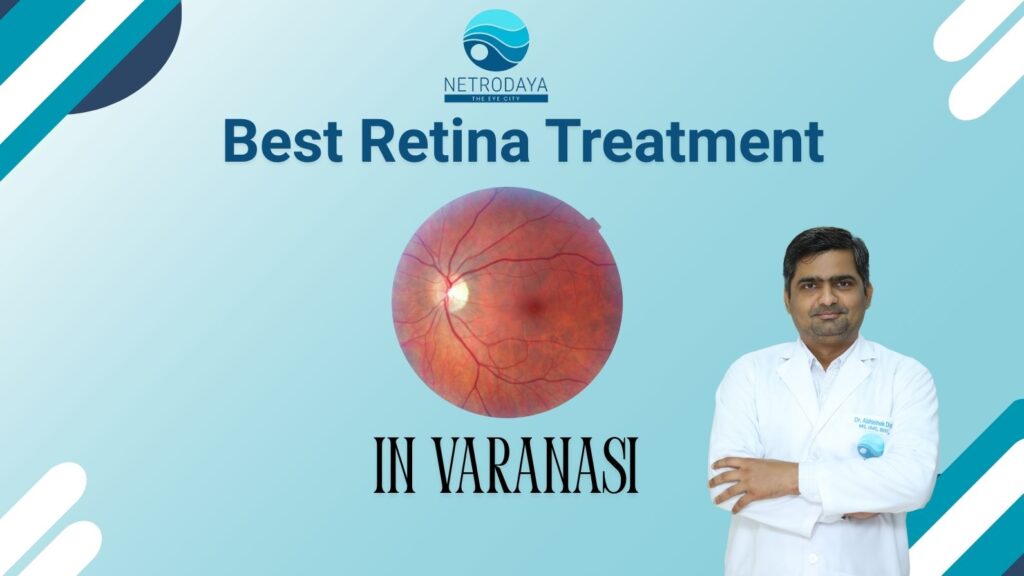 Protecting Your Precious Sight: Finding Varanasi’s Best Retina Treatment at Netrodaya The Eye City Protecting Your Precious Sight: Finding Varanasi’s Best Retina Treatment at Netrodaya The Eye City