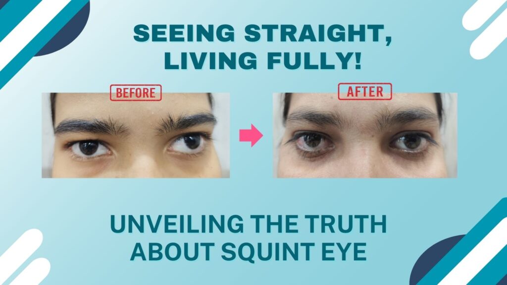 Unveiling the Truth About Squint Eye in Varanasi Unveiling the Truth About Squint Eye in Varanasi