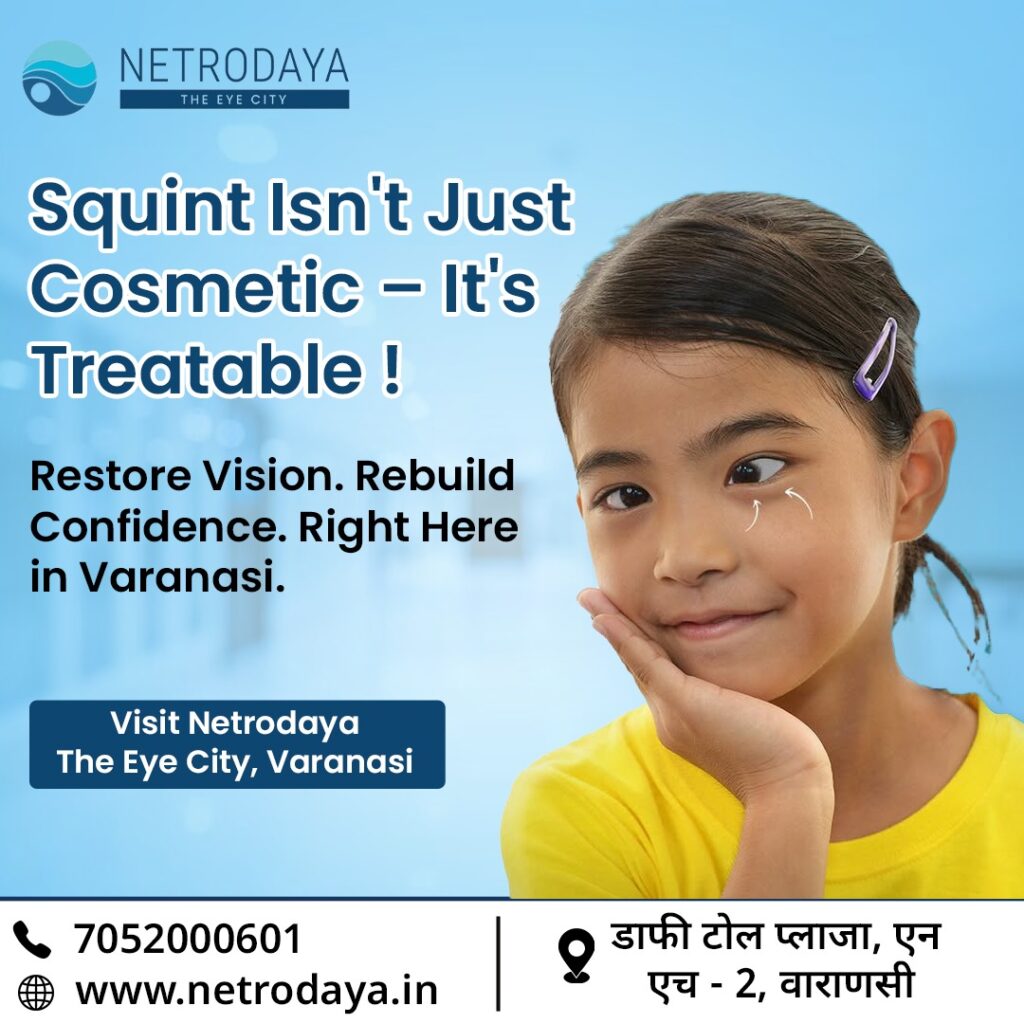squint eye treatment in Varanasi