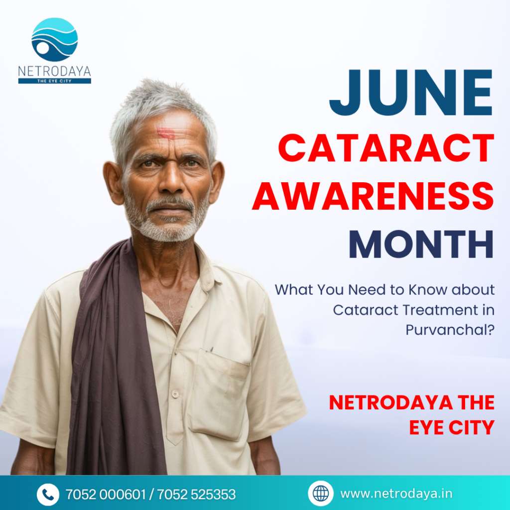 best cataract surgery in Varanasi