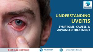 Uveitis Treatment in Varanasi