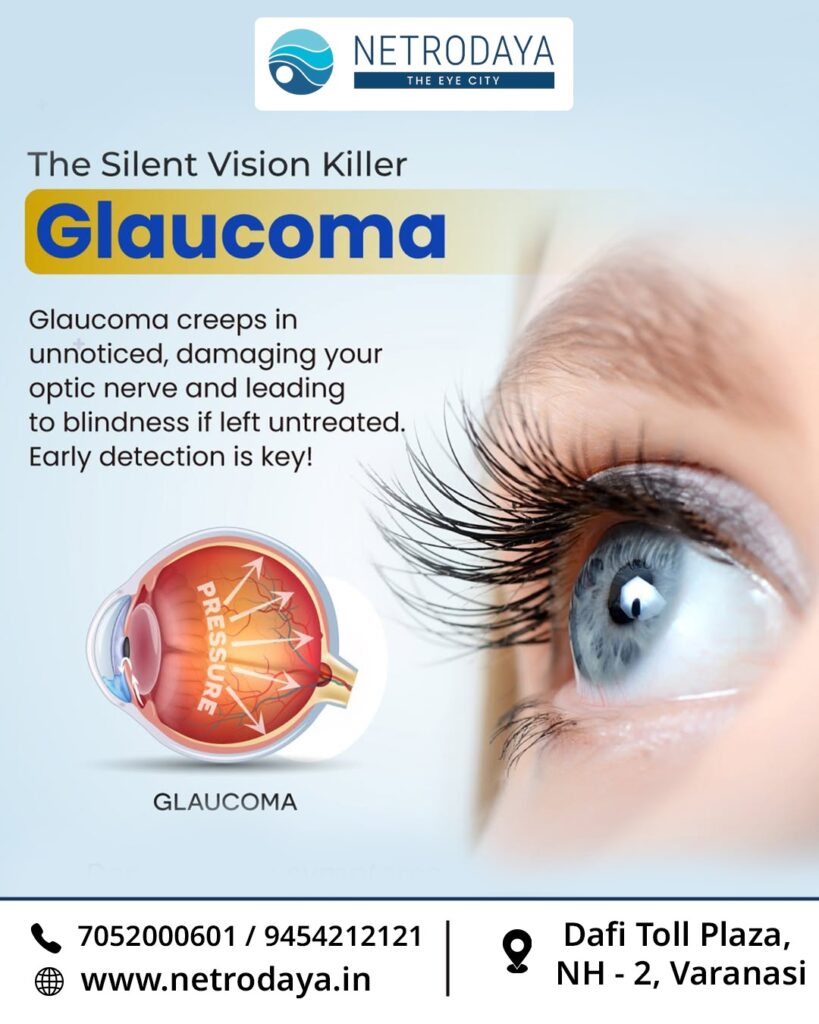 Glaucoma varanasi